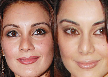 Minisha Lamba Nose Job